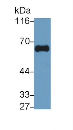 γ-谷氨酰转移酶1(gGT1)单克隆抗体