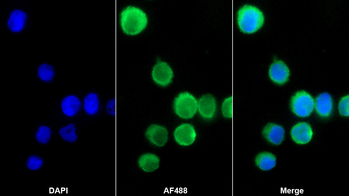 補(bǔ)體成分1q受體(C1qR1)單克隆抗體