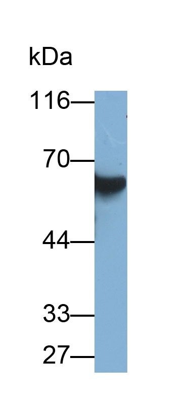 唾液淀粉酶α1(AMY1A)单克隆抗体