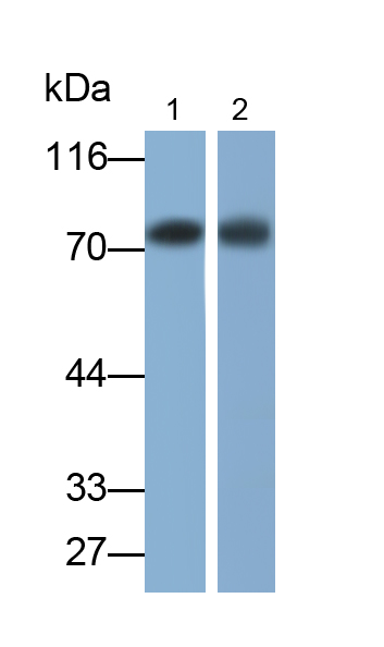 白介素5受體α(IL5Ra)單克隆抗體