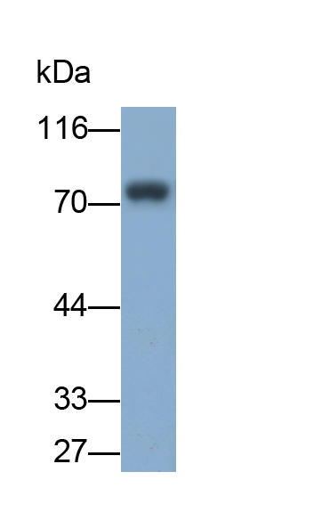 白介素5受体α(IL5Ra)单克隆抗体
