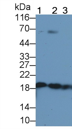 絲切蛋白1(CFL1)單克隆抗體
