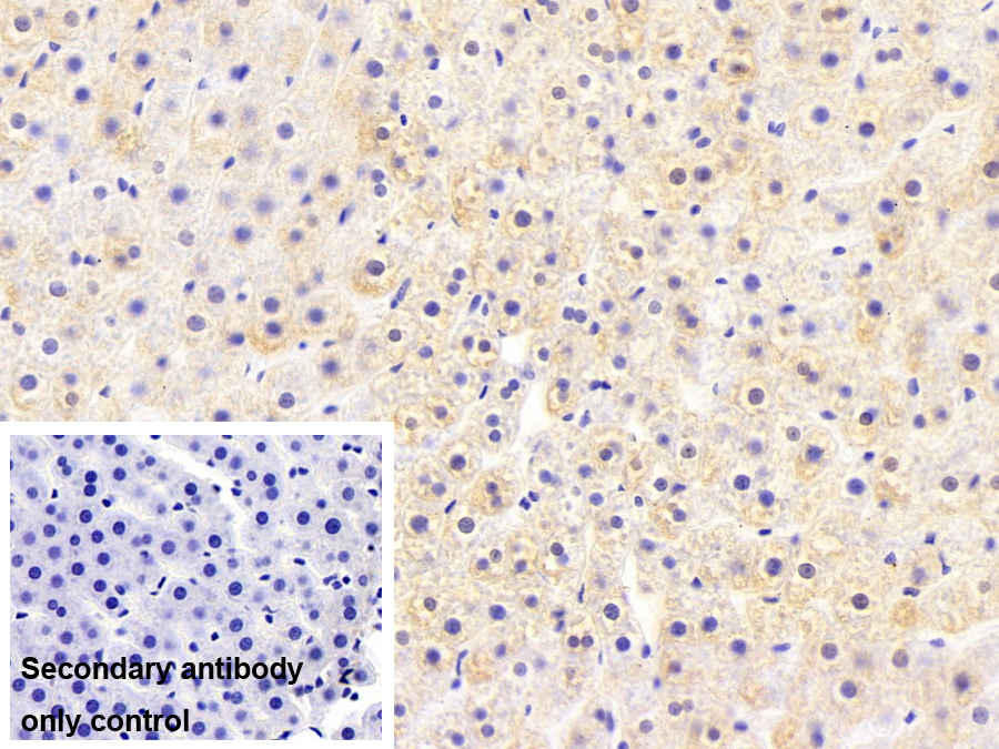 脂肪酸结合蛋白1(FABP1)单克隆抗体