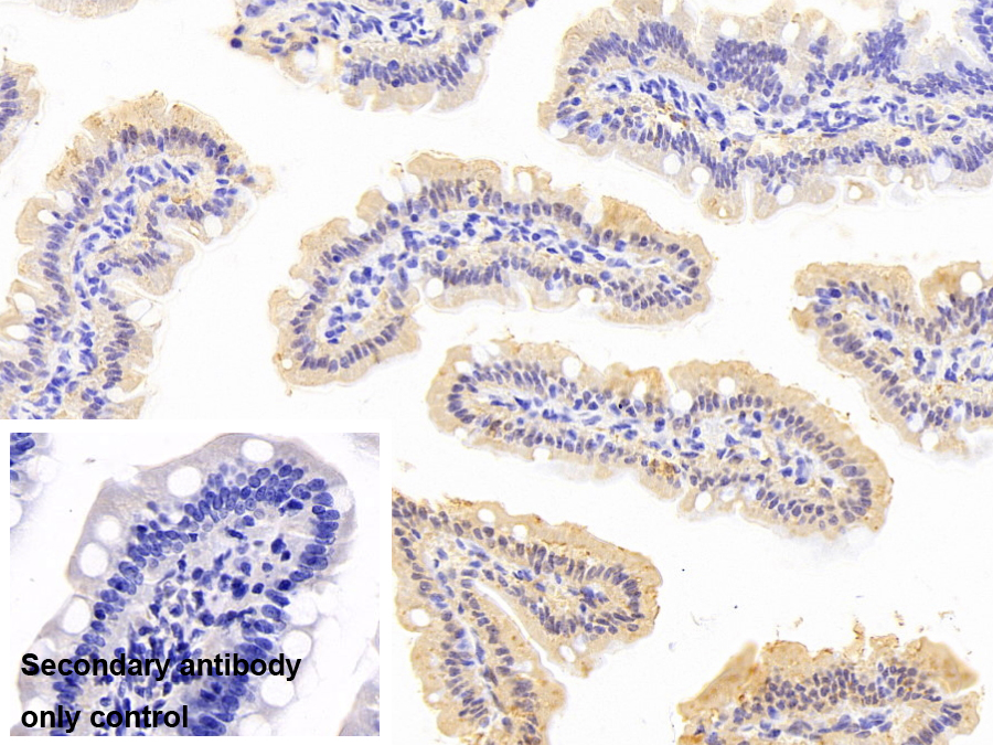 脂肪酸结合蛋白1(FABP1)单克隆抗体