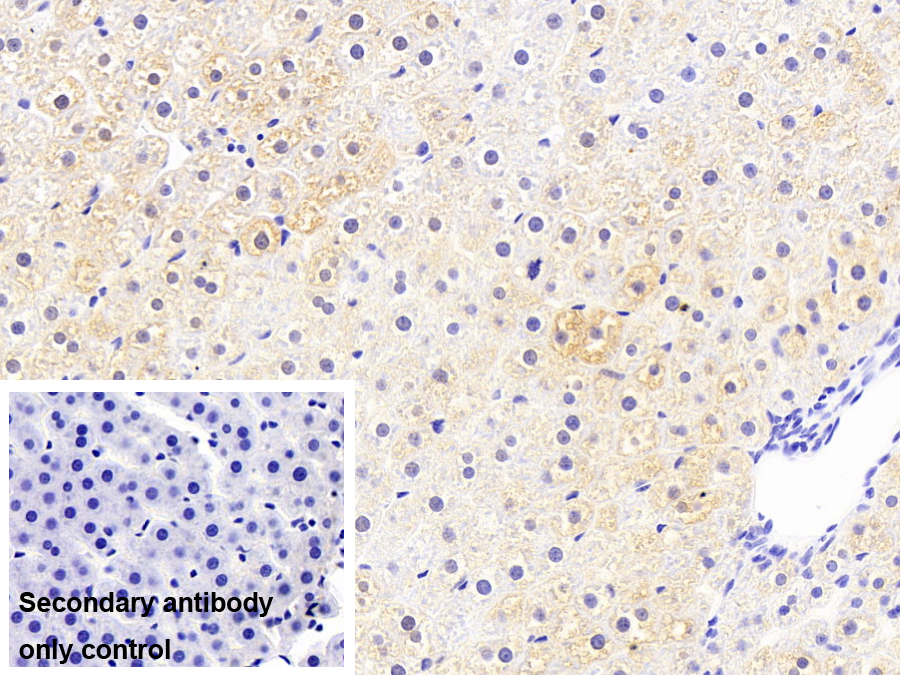 脂肪酸结合蛋白1(FABP1)单克隆抗体