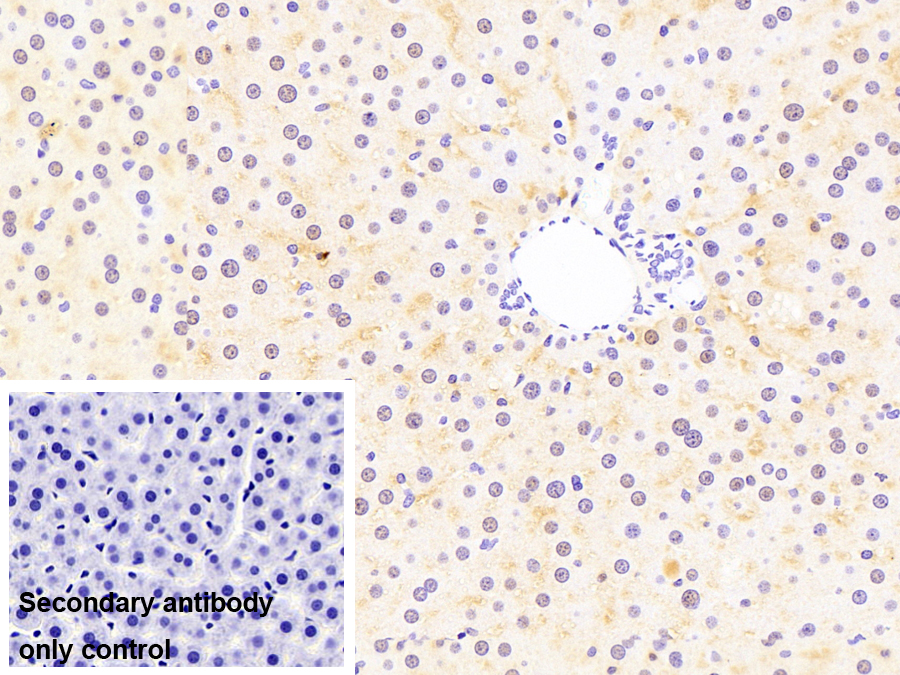 脂肪酸結(jié)合蛋白1(FABP1)單克隆抗體