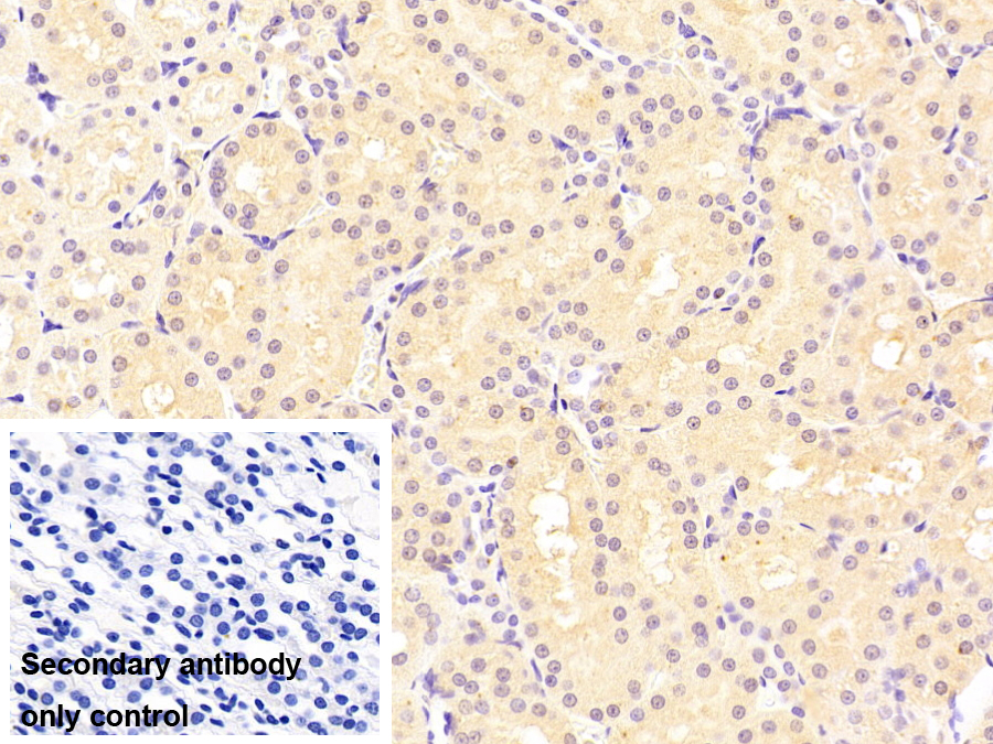 脂肪酸結(jié)合蛋白1(FABP1)單克隆抗體