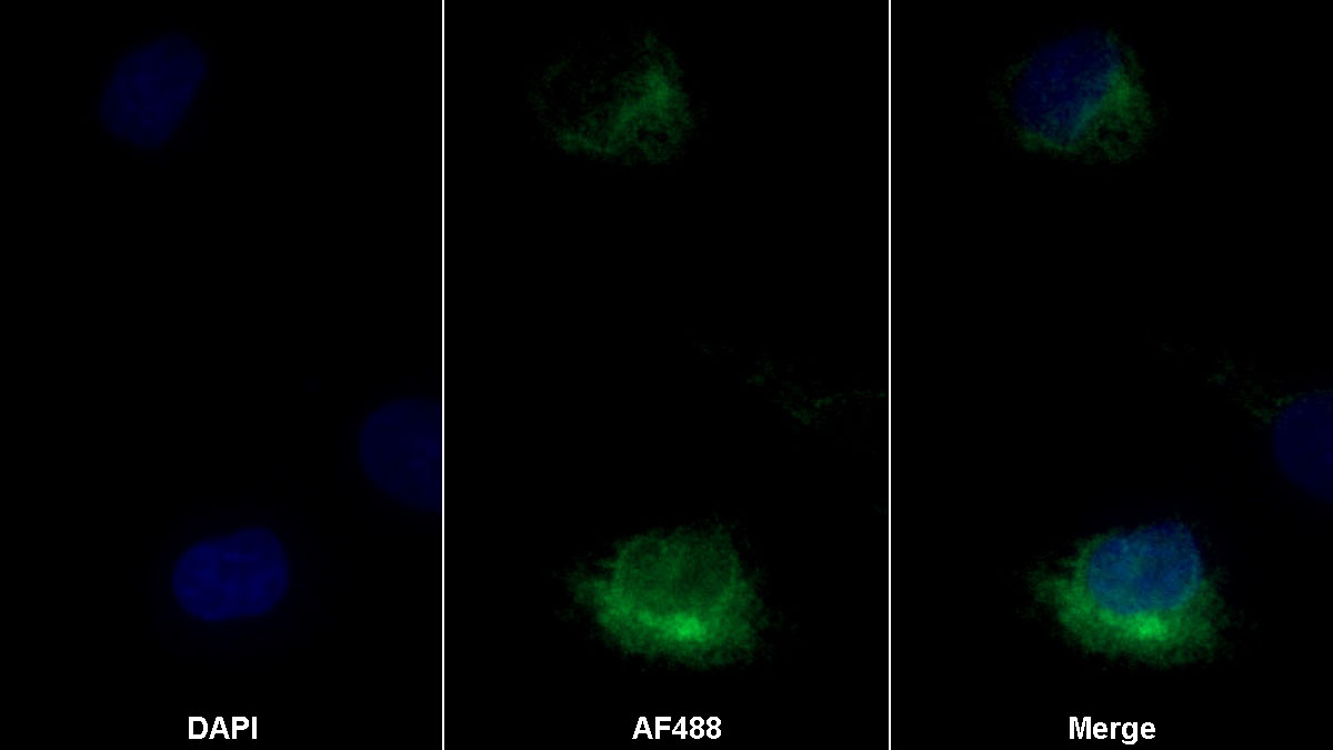 CD164分子(CD164)单克隆抗体