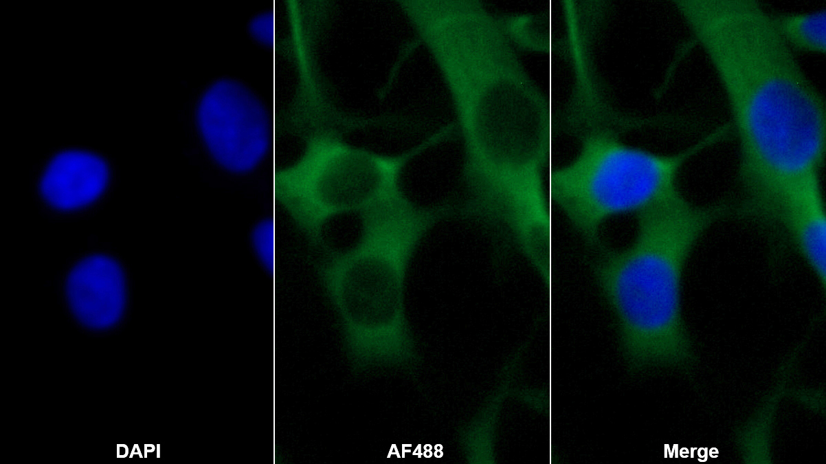 主要堿性蛋白(MBP)單克隆抗體