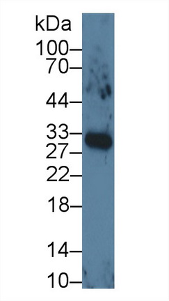 血管内皮生长因子165(VEGF165)单克隆抗体