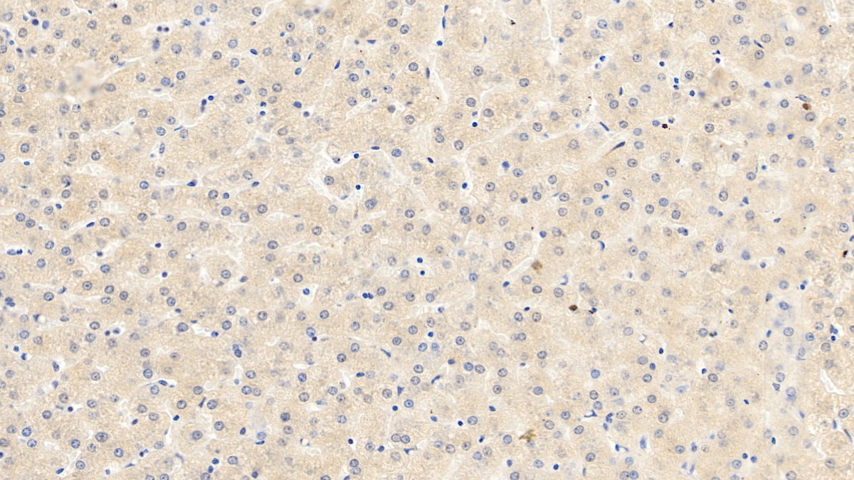 血管内皮生长因子165(VEGF165)单克隆抗体