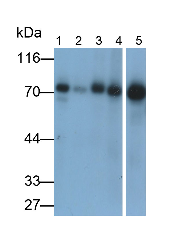 血管内皮生长因子165(VEGF165)单克隆抗体