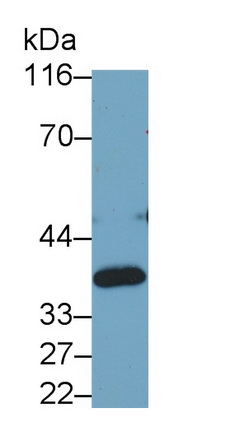 乳酸脱氢酶B(LDHB)单克隆抗体