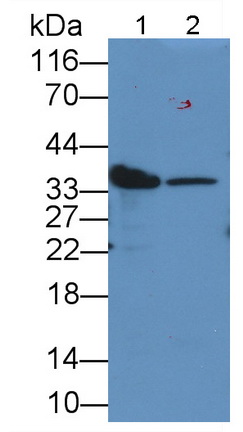 乳酸脫氫酶B(LDHB)單克隆抗體