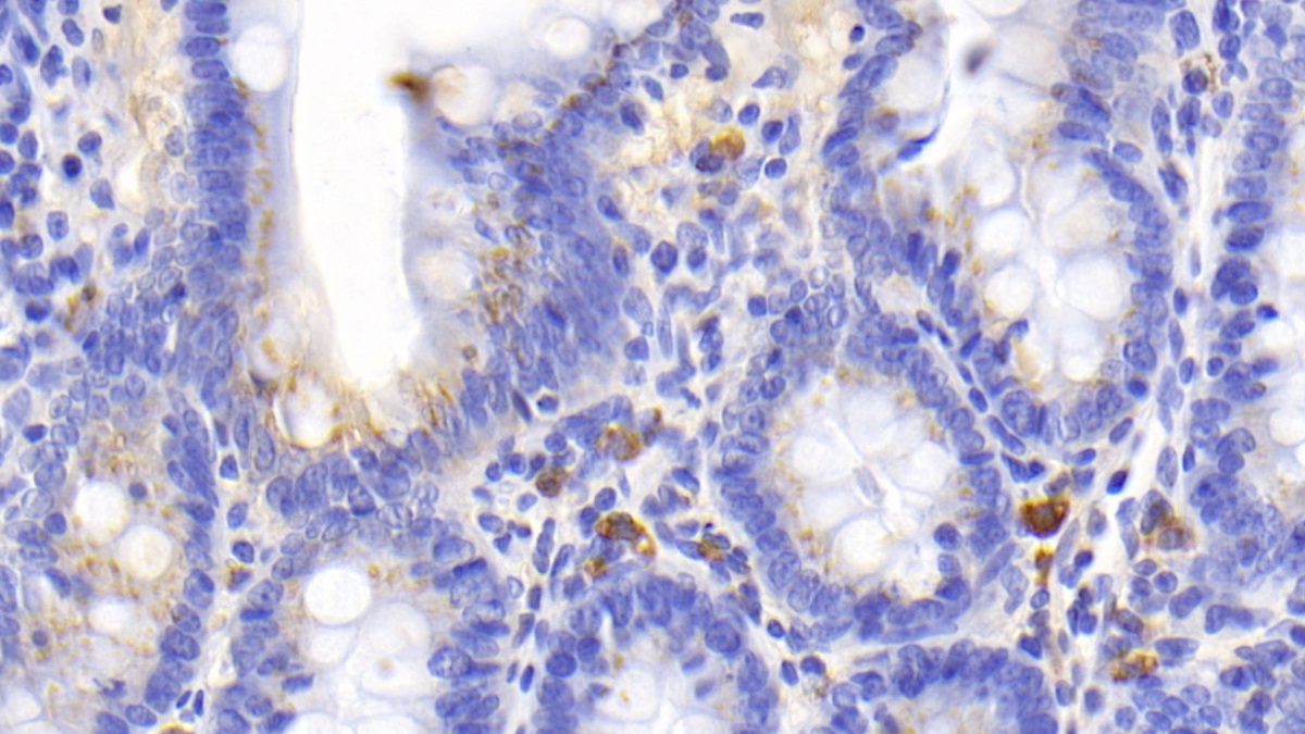 CD163分子(CD163)单克隆抗体