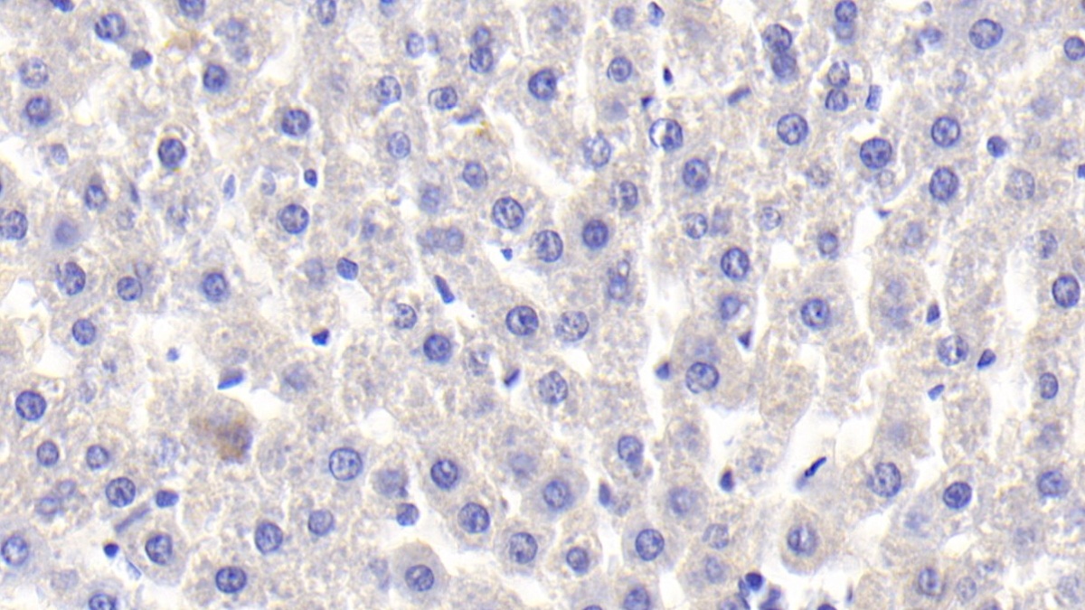 CD163分子(CD163)单克隆抗体