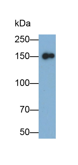 CD163分子(CD163)单克隆抗体