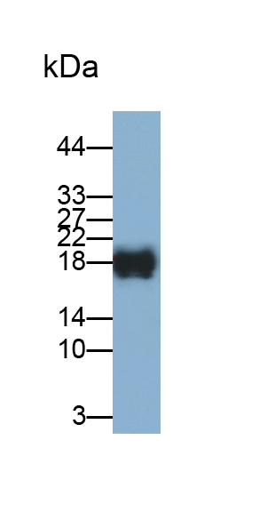 再生胰岛衍生蛋白1α(REG1a)单克隆抗体
