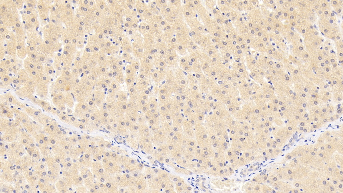 抑制素βB(INHbB)單克隆抗體