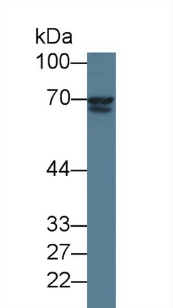 可溶性半乳糖凝集素3結(jié)合蛋白(LGALS3BP)單克隆抗體