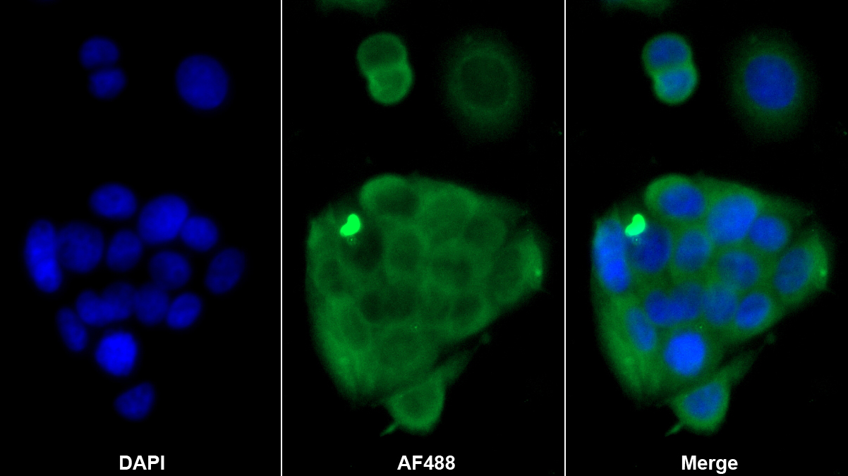 S100鈣結(jié)合蛋白A6(S100A6)單克隆抗體