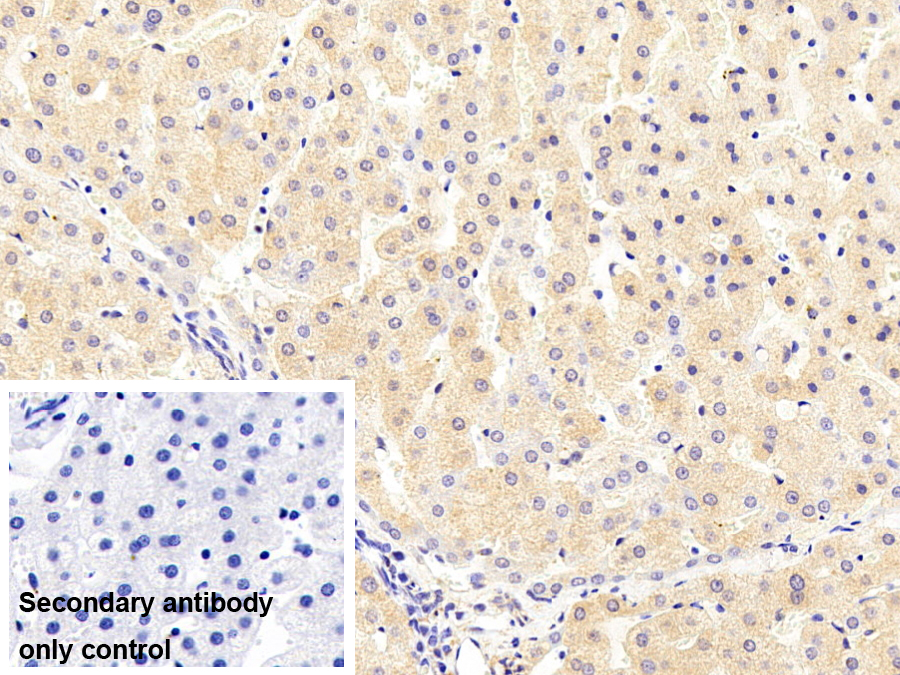 類粘蛋白2(ORM2)單克隆抗體