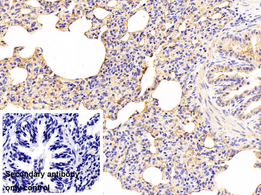 類粘蛋白2(ORM2)單克隆抗體