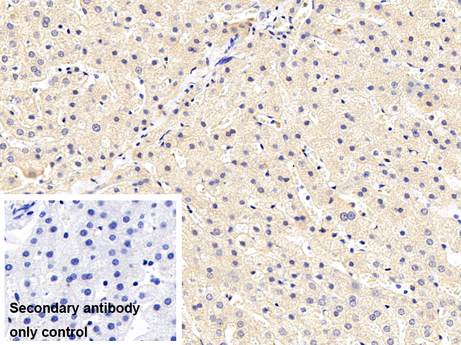 類粘蛋白2(ORM2)單克隆抗體