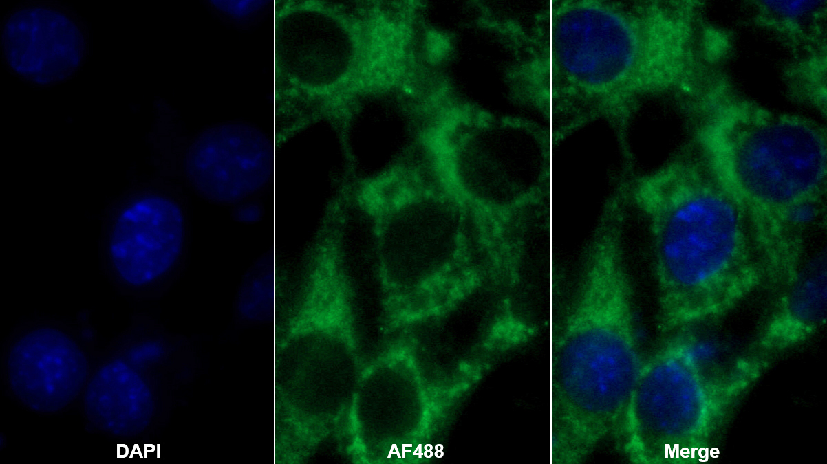 維生素D結(jié)合蛋白(DBP)單克隆抗體