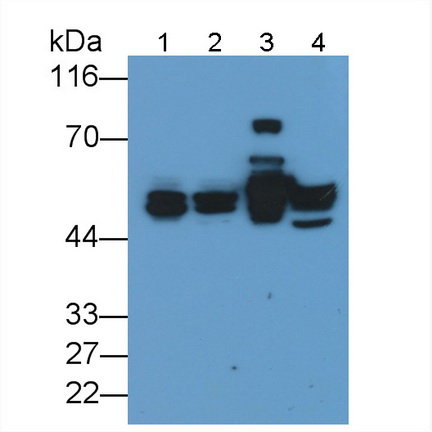 角蛋白17(CK17)單克隆抗體