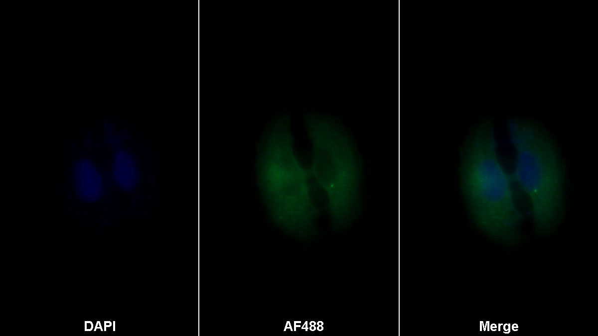 白介素2受體α(IL2Ra)單克隆抗體