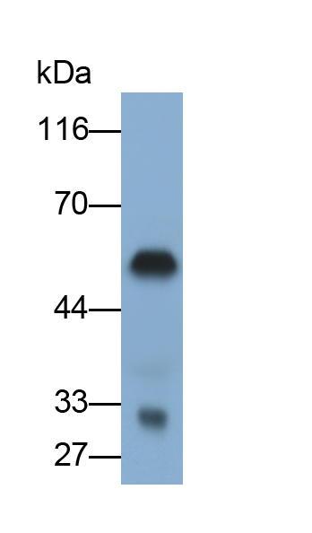 白介素2受体α(IL2Ra)单克隆抗体