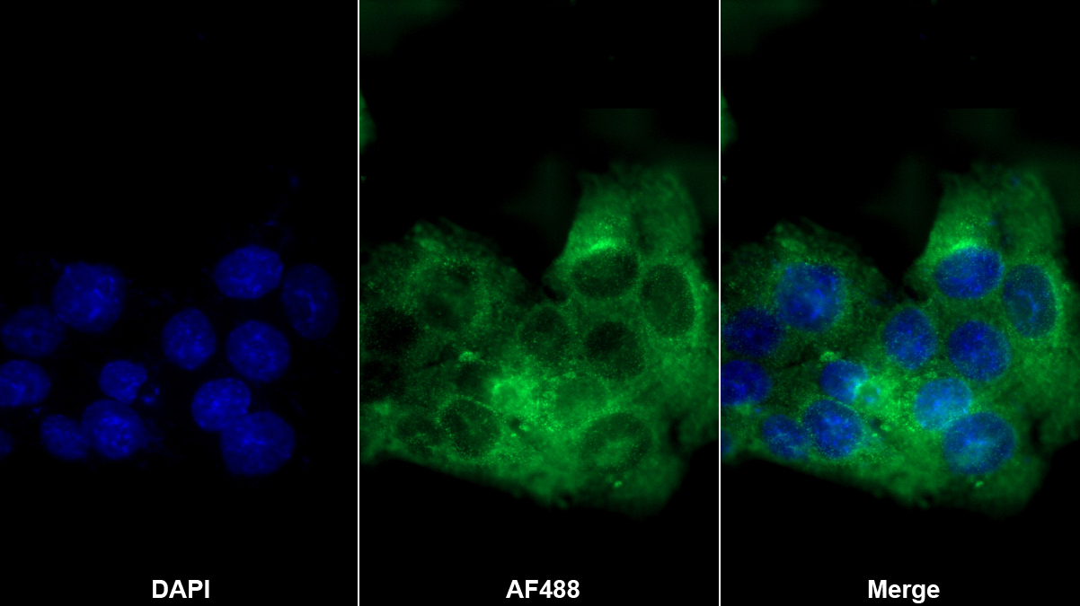載脂蛋白C3(APOC3)單克隆抗體
