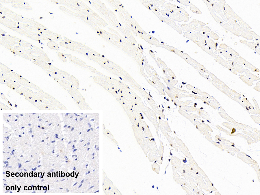 43kDa Tar DNA結(jié)合蛋白(TDP43)單克隆抗體