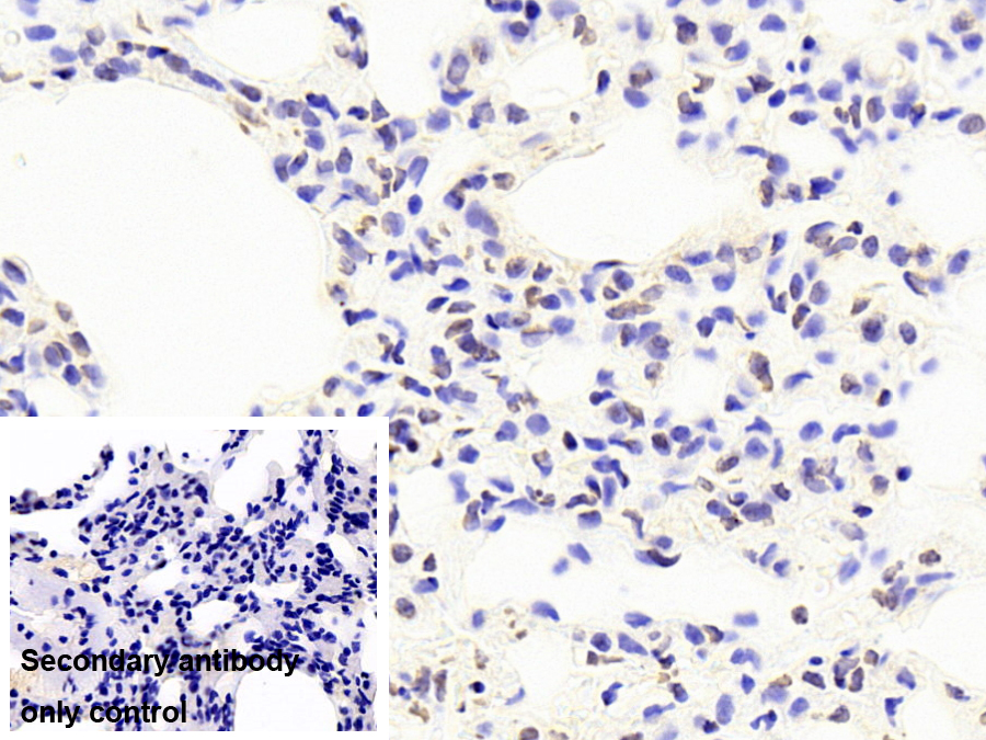 43kDa Tar DNA結(jié)合蛋白(TDP43)單克隆抗體