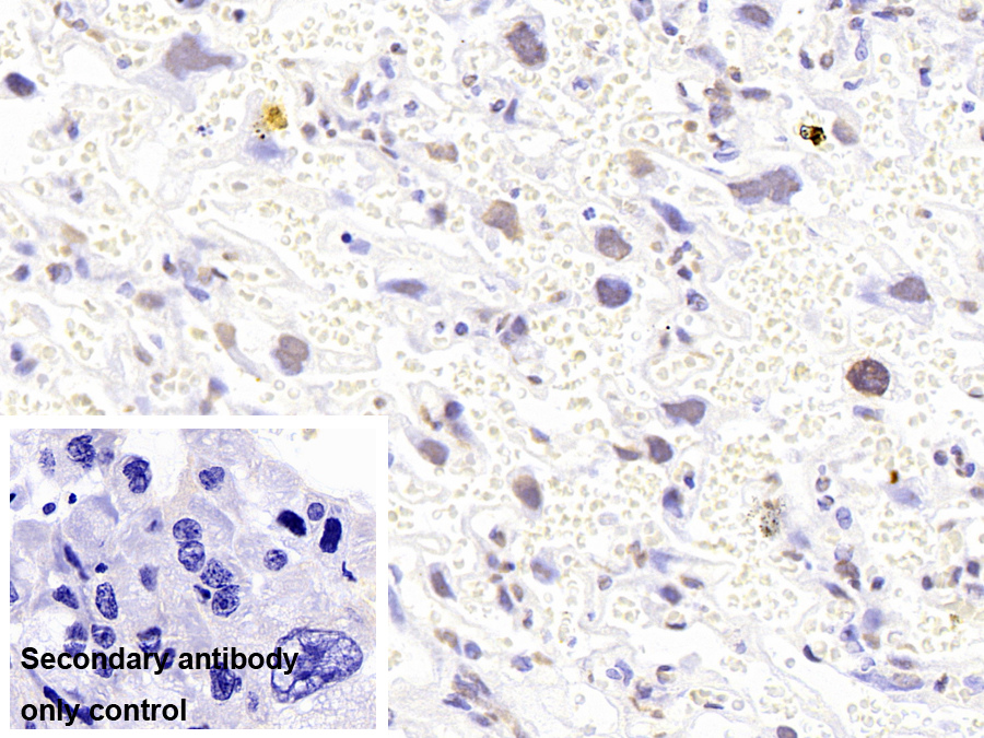 43kDa Tar DNA結(jié)合蛋白(TDP43)單克隆抗體