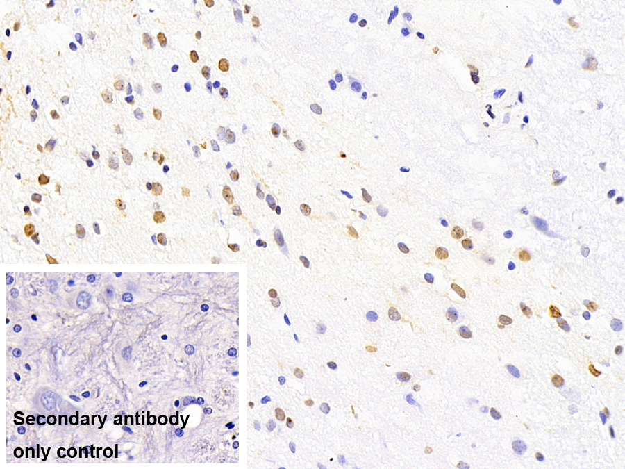 43kDa Tar DNA結(jié)合蛋白(TDP43)單克隆抗體