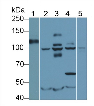 CD34分子(CD34)單克隆抗體