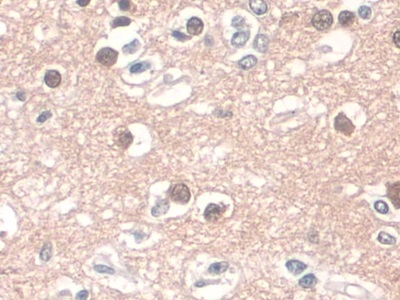 CD34分子(CD34)单克隆抗体