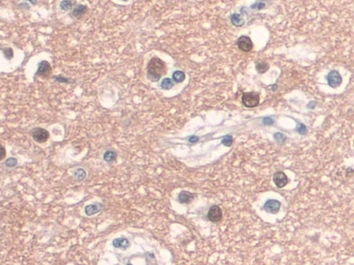 CD34分子(CD34)單克隆抗體