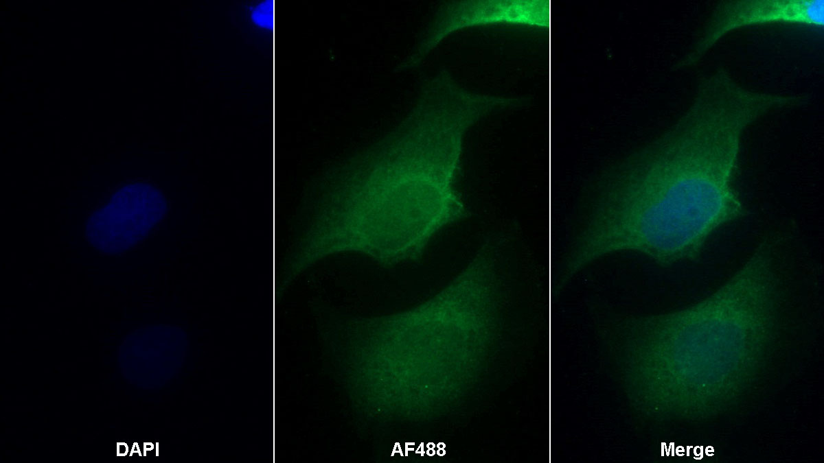 CD34分子(CD34)单克隆抗体