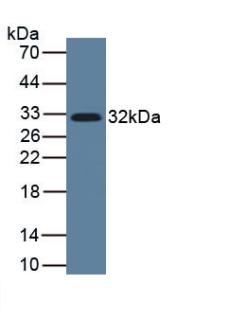 白介素33(IL33)單克隆抗體