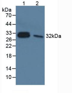 白介素33(IL33)單克隆抗體