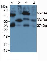 白介素33(IL33)單克隆抗體