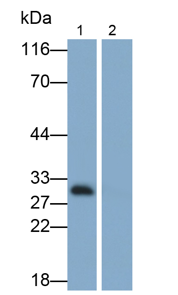白介素33(IL33)單克隆抗體