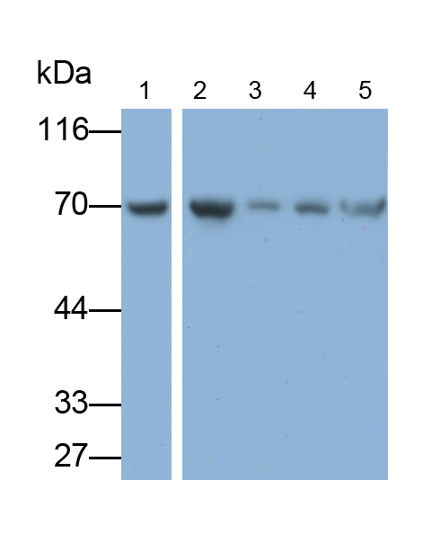 τ-蛋白激酶1(tPK1)单克隆抗体