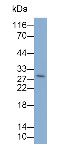 白介素35(IL35)单克隆抗体