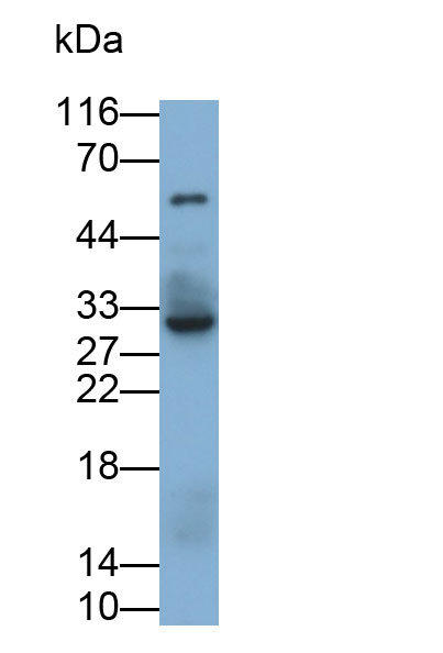 白介素35(IL35)单克隆抗体
