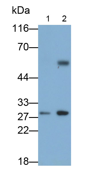 白介素35(IL35)单克隆抗体