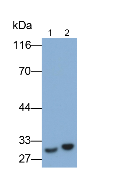 白介素35(IL35)单克隆抗体